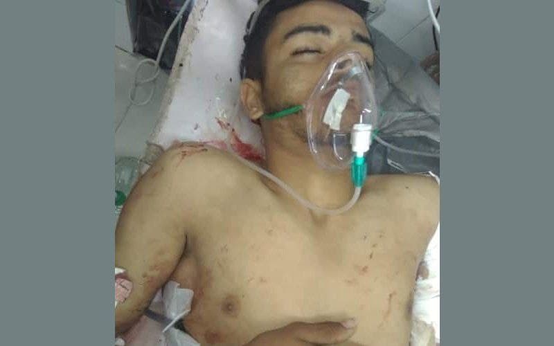 وفاة لاعب كرة قدم متأثراً بإصابته برصاص مسلح حوثي في إب