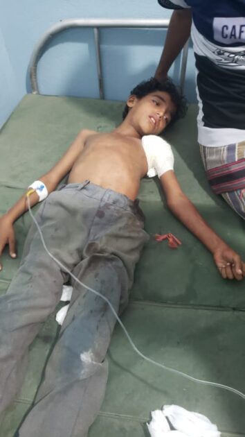 إصابة طفل برصاص مليشيا الحوثي في حيس