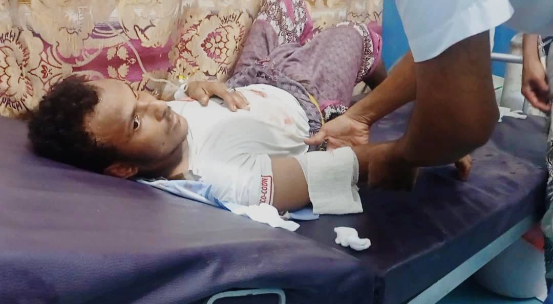 اصابة مواطن برصاص مليشيا الحوثي في حيس