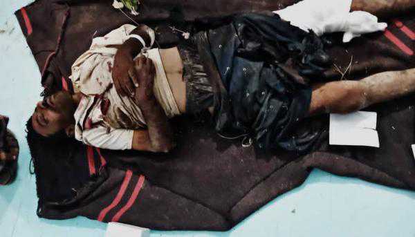 مقتل مواطن بلغم حوثي اثناء زيارته لأقاربه في حيس جنوب الحديدة