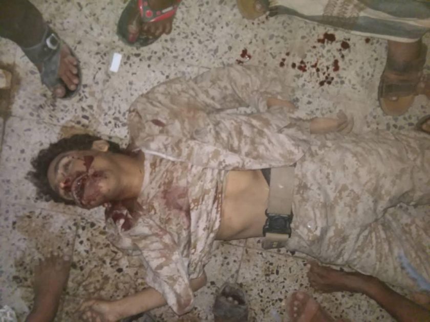 صورة |قتلى الحوثيين في الهجوم الفاشل على حيس