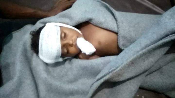الحديدة: حقوق الانسان تدين مقتل طفل وامرأة بقصف حوثي في حيس