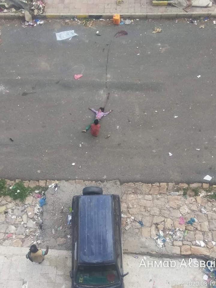 "صور"مليشيا الحوثي تقنص طفلة بتعز وآخر يضحي بحياته من أجل انقاذها