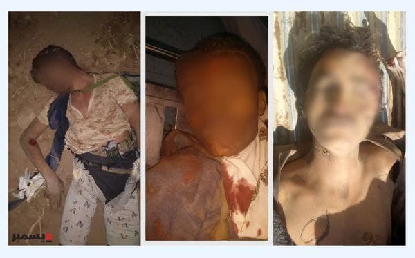 بالصور.. 11 جثة خلفتها مليشيا الحوثي إثر هجوم فاشل على حيس