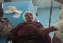 رصاصة قناص حوثي تصيب طفل في حيس جنوب الحديدة