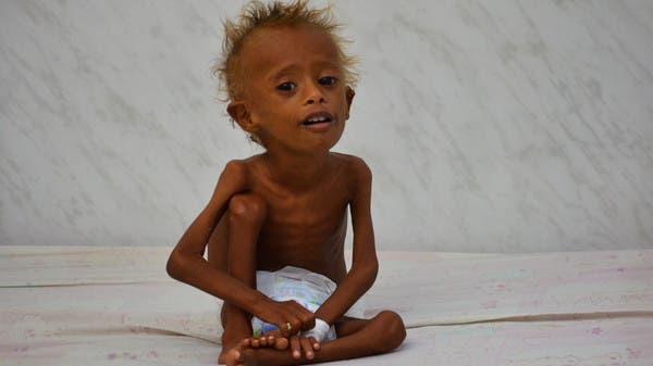 تقرير أممي يحذِّر من انتشار المجاعة في حجة والحديدة