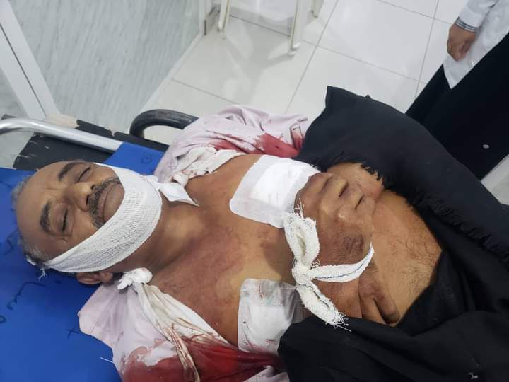 مقتل مدني برصاص قناص حوثي في تعز