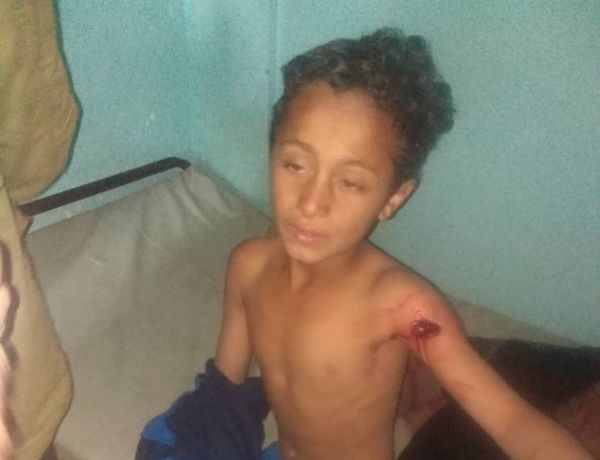 وزارة حقوق الإنسان تدين جريمة إرهابية حوثية بحق الطفولة في تعز