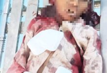 مقتل طفل وإصابة آخرين بقصف مسيرة تابعة لمليشيا الحوثي في حيس جنوب الحديدة