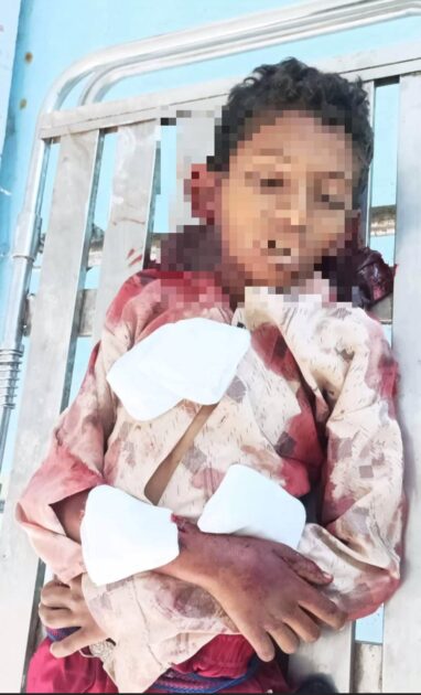 مقتل طفل وإصابة آخرين بقصف مسيرة تابعة لمليشيا الحوثي في حيس جنوب الحديدة