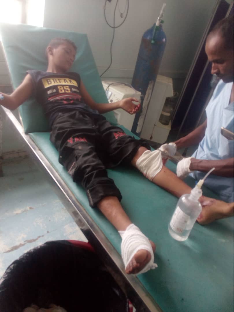 إصابة 5 أطفال بقصف مدفعي حوثي على تجمعات سكانية في حيس (صور)