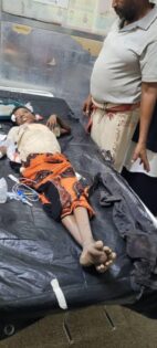 مقتل وإصابة 5 أطفال بإنفجار مقذوف من مخلفات مليشيا الحوثي بلحج