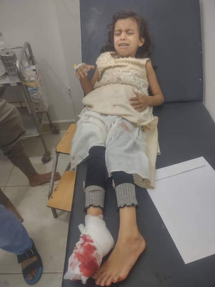 إصابة طفلة وشقيقها برصاص قناصة مليشيا الحوثي في تعز