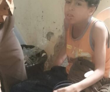 إصابة طفل برصاص قناصة مليشيا الحوثي في الشقب بتعز