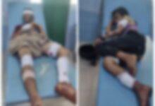 إصابات بالغة لشقيقين بانفجار عبوة ناسفة من مخلفات الحوثي في تعز