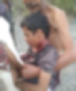 إصابة طفل برصاص قناصة مليشيا الحوثي شمال لحج