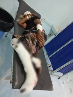استمرار الكابوس.. انفجار لغم حوثي يودي بحياة مدني وإصابة شقيقه في جنوب الحديدة استمرار الكابوس.. انفجار لغم حوثي يودي بحياة مدني وإصابة شقيقه في جنوب الحديدة