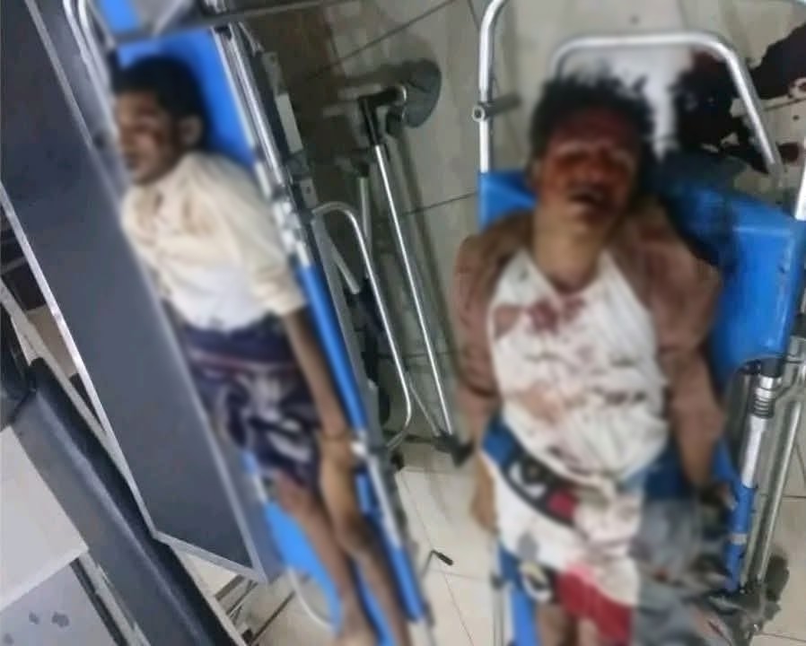 وفاة شخصين بحادث مروري على خط زبيد بالحديدة