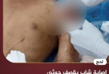 إصابة شاب بقصف حوثي على قرية سكنية في المسيمير- لحج