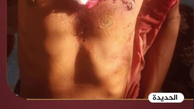 سمكة تقتل صيادًا تهاميًا من أبناء الخوخة بطعنة نافذة
