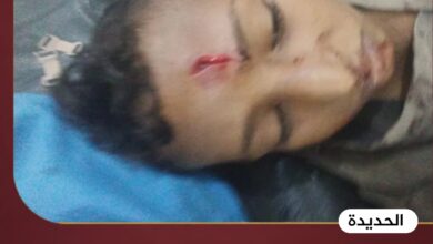 الحديدة.. إصابة طفل بانفجار مقذوف من مخلفات مليشيا الحوثي
